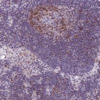 Anti-PQLC1 antibody produced in rabbit 