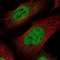Anti-PQLC1 antibody produced in rabbit 