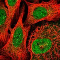 Anti-PQLC2L antibody produced in rabbit 
