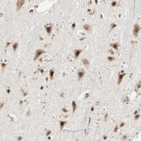 Anti-PRDM2 antibody produced in rabbit 