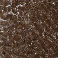 Anti-PREB antibody produced in rabbit