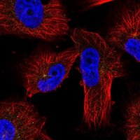 Anti-PRKAR2A antibody produced in rabbit 