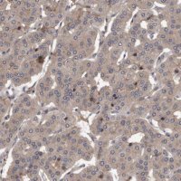 Anti-PRKD1 antibody produced in rabbit 