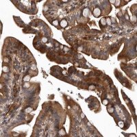 Anti-PRKD3 antibody produced in rabbit 