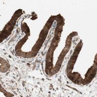 Anti-PRKG1 antibody produced in rabbit 