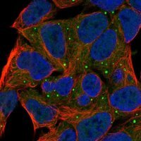 Anti-PRKG1 antibody produced in rabbit 