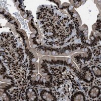 Anti-PRKX antibody produced in rabbit 
