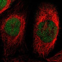 Anti-PRKX antibody produced in rabbit 
