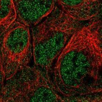 Anti-PRMT2 antibody produced in rabbit HPA018976-100UL
