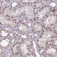 Anti-PRMT6 antibody produced in rabbit 