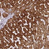 Anti-PRODH2 antibody produced in rabbit 