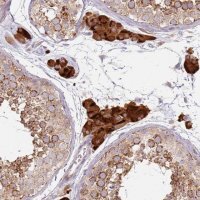 Anti-PROKR2 antibody produced in rabbit 