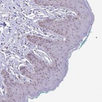 Anti-PROSER1 antibody produced in rabbit 