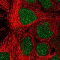 Anti-PROSER1 antibody produced in rabbit 