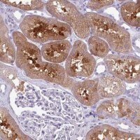 Anti-PRPF38A antibody produced in rabbit HPA053099-100UL