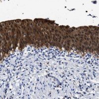 Anti-PRPF4B antibody produced in rabbit 