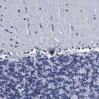 Anti-PRPF4B antibody produced in rabbit 