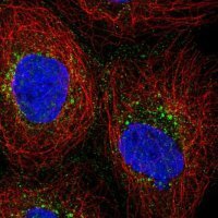 Anti-PRPS2 antibody produced in rabbit 