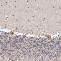 Anti-PRR12 antibody produced in rabbit 