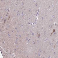 Anti-PRR14L antibody produced in rabbit 