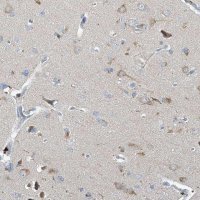 Anti-PRSS12 antibody produced in rabbit 