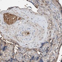Anti-PRSS23 antibody produced in rabbit 