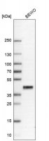 Anti-PRSS8 antibody produced in rabbit 