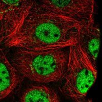 Anti-PRTFDC1 antibody produced in rabbit 