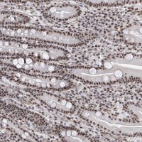 Anti-PRUNE2 antibody produced in rabbit 