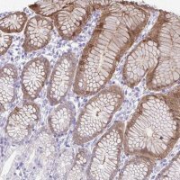Anti-PSCA antibody produced in rabbit HPA056418-100UL