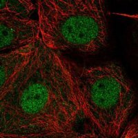 Anti-PSD antibody produced in rabbit