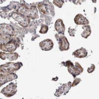 Anti-PSMB2 antibody produced in rabbit 