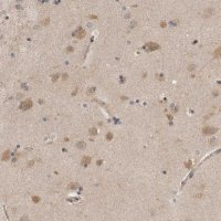Anti-PSMB2 antibody produced in rabbit 