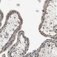 Anti-PSMB4 antibody produced in rabbit HPA006700-100UL