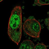 Anti-PSMB6 antibody produced in rabbit HPA063656-100UL