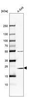 Anti-PSMB6 antibody produced in rabbit HPA063656-100UL