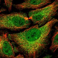 Anti-PSMB7 antibody produced in rabbit 
