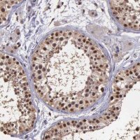 Anti-PSMC1 antibody produced in rabbit 