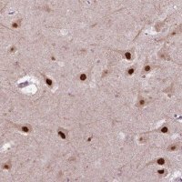 Anti-PSMC2 antibody produced in rabbit 