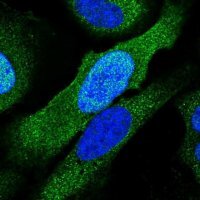 Anti-PSMC6 antibody produced in rabbit 