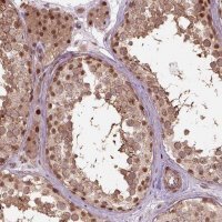 Anti-PSMD11 antibody produced in rabbit HPA067433-100UL