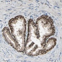 Anti-PSMD5 antibody produced in rabbit 