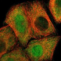 Anti-PSMD5 antibody produced in rabbit 