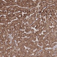Anti-PSMD6 antibody produced in rabbit