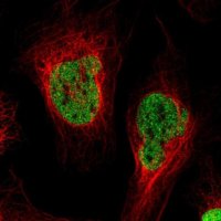 Anti-PSME3 antibody produced in rabbit