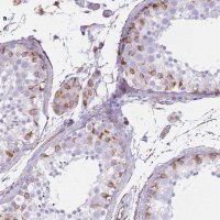 Anti-PTCD1 antibody produced in rabbit 