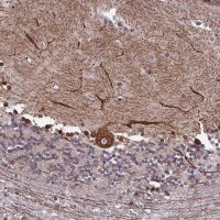 Anti-PTCHD4 antibody produced in rabbit 