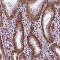 Anti-PTCHD4 antibody produced in rabbit 