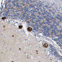 Anti-PTDSS1 antibody produced in rabbit