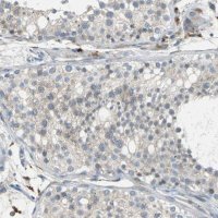 Anti-PTGDS antibody produced in rabbit 